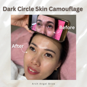Dark Circle Skin Camouflage